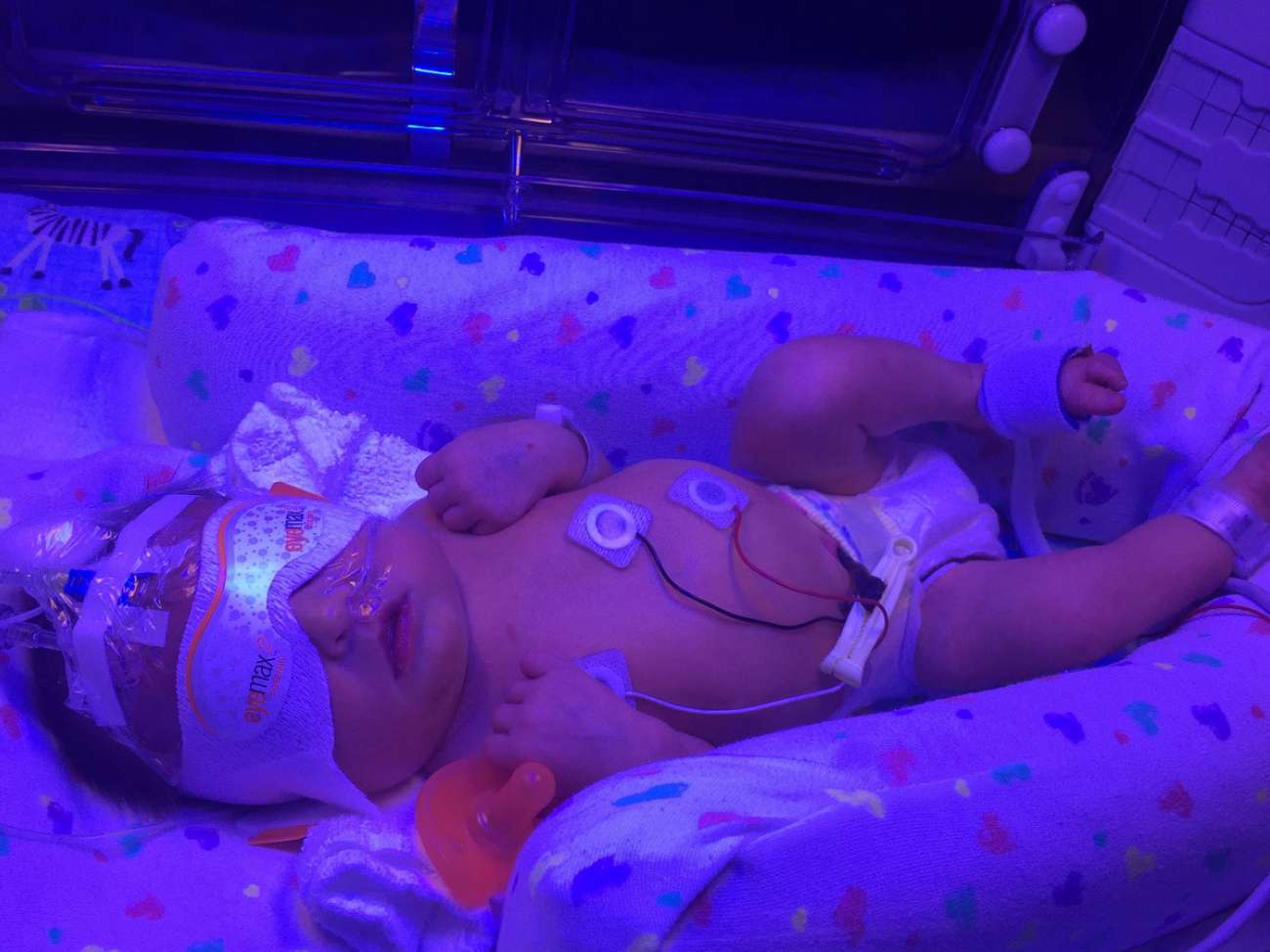 Mateo as a newborn in GRH's neonatal intensive care unit