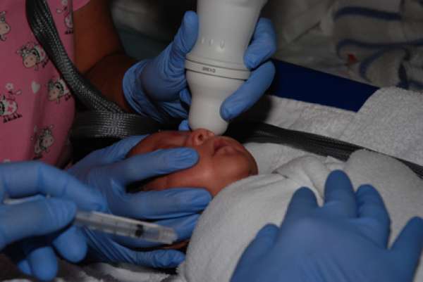 A photo of a baby undergoing ROP screening