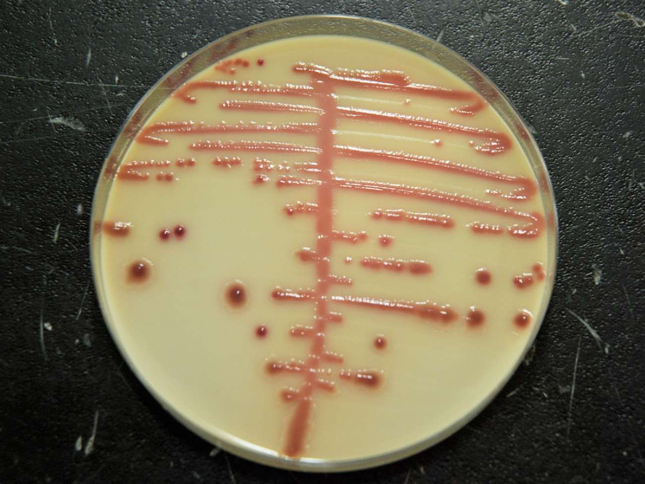 Manual streaking of plates to grow pathogens took time, was less consistent, and could streak less of the plate.