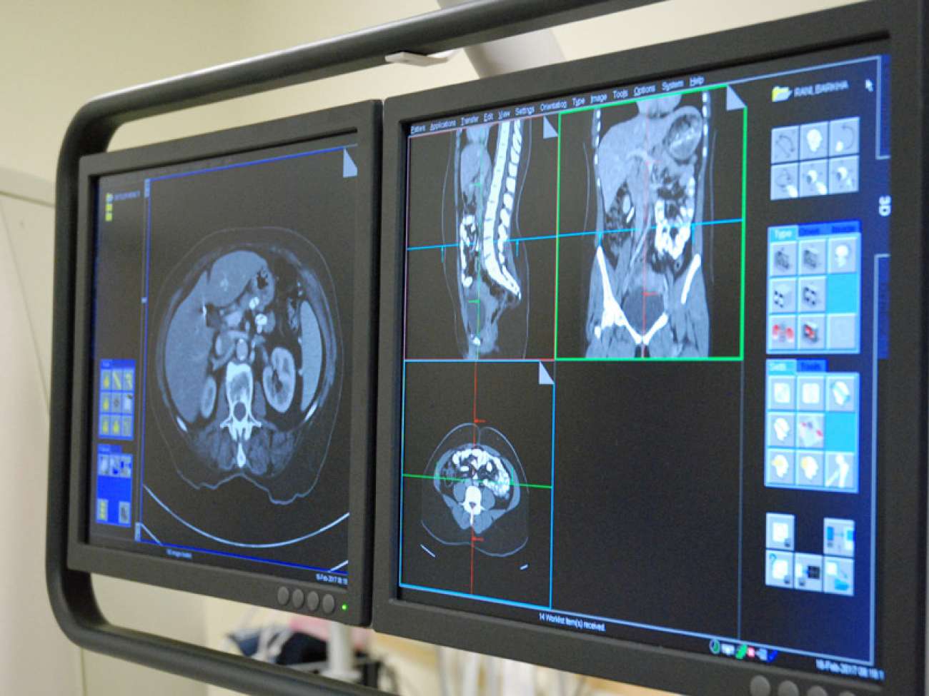 Close up images on the CT scanner's monitor
