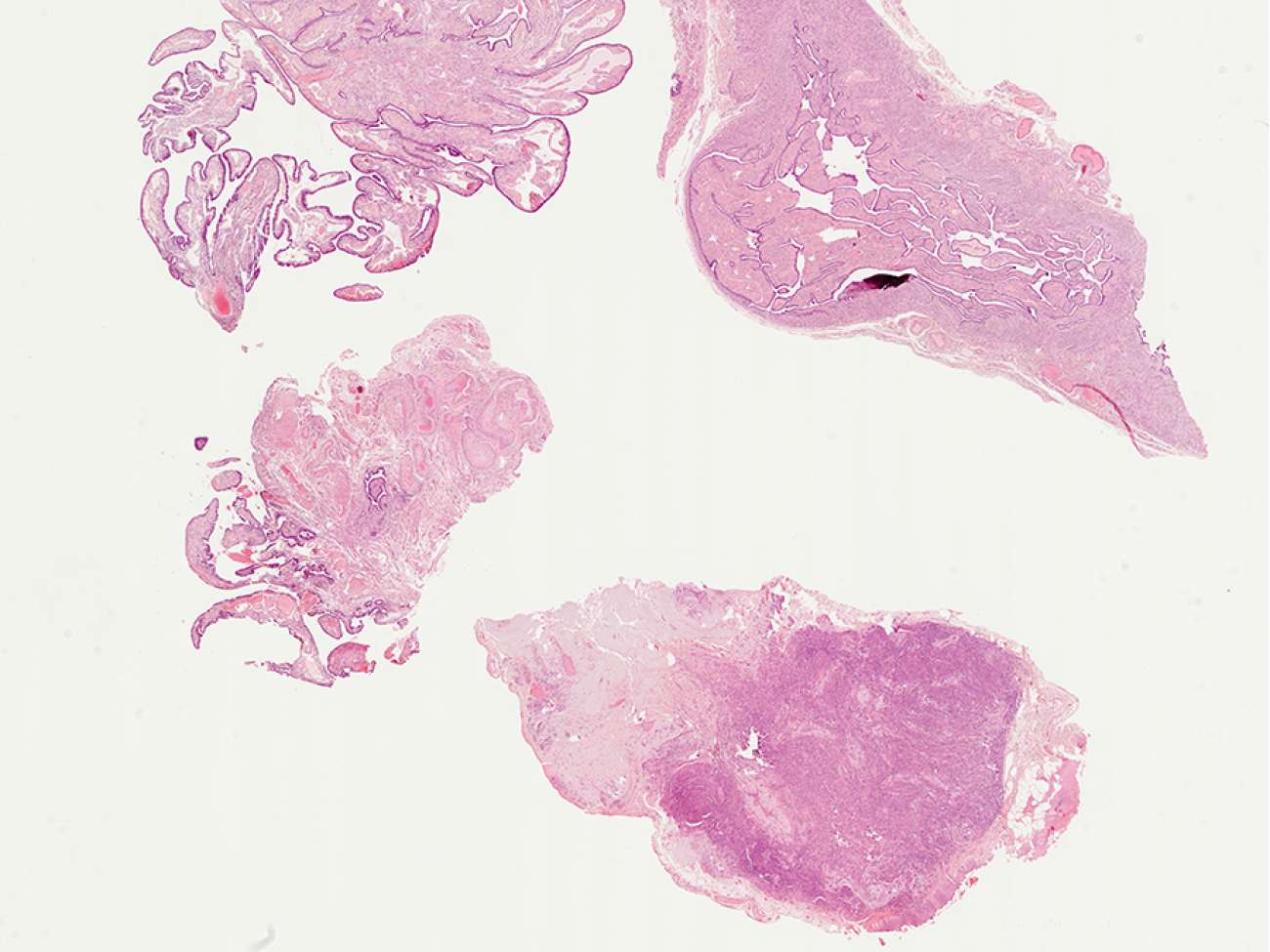 An example of a digital biopsy slide that may be used in this research study. Photo courtesy of Huron Digital Pathology