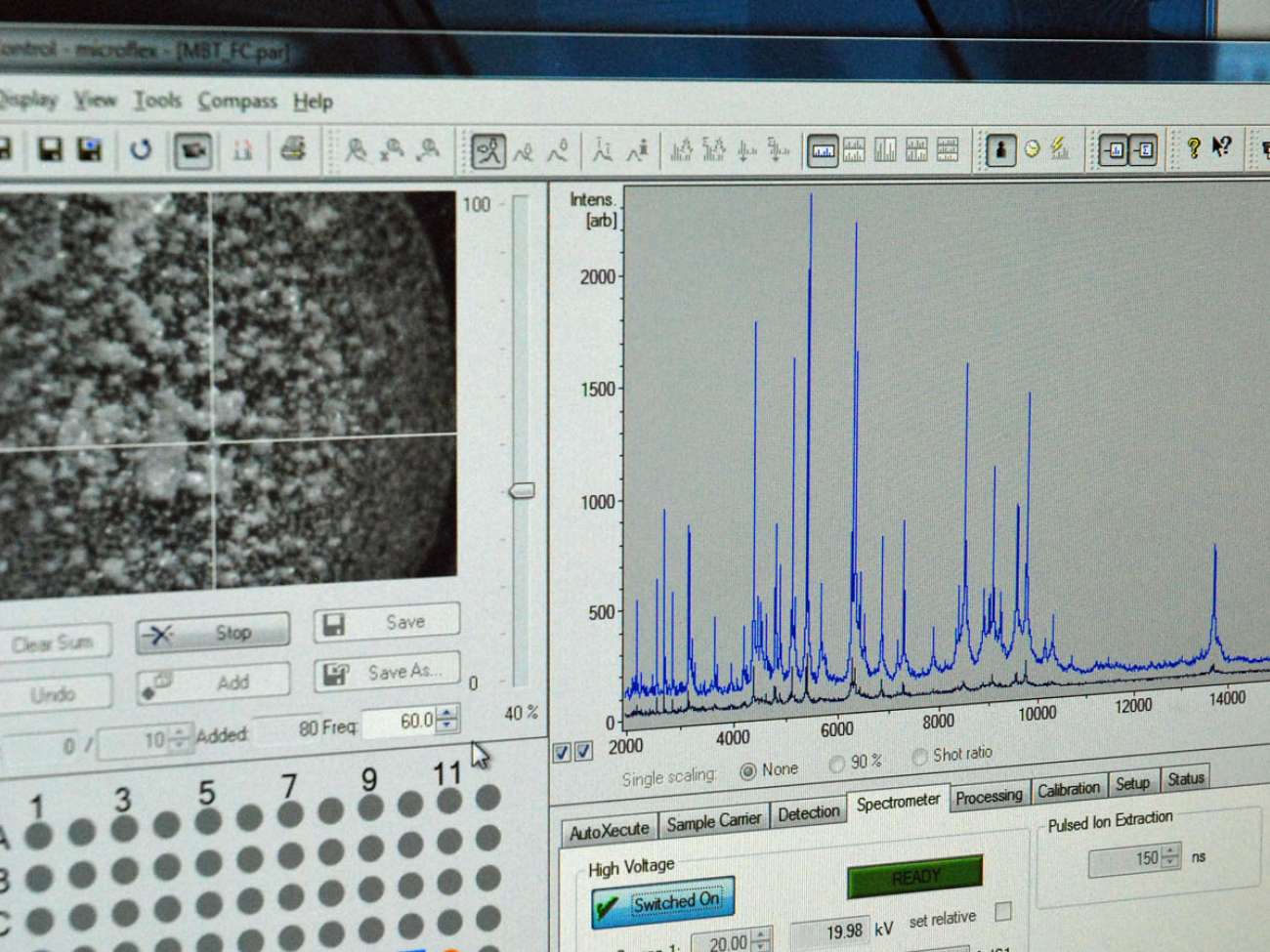 The instrument creates a vacuum and uses laser testing to identify each organism. Testing time takes 10 to 15 minutes, depending on the number or organisms requiring identification. Previous methods could take upwards of 24 hours.