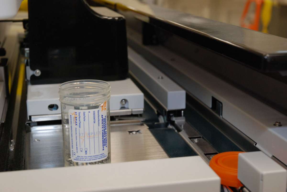 A photo of a lab specimen collection container