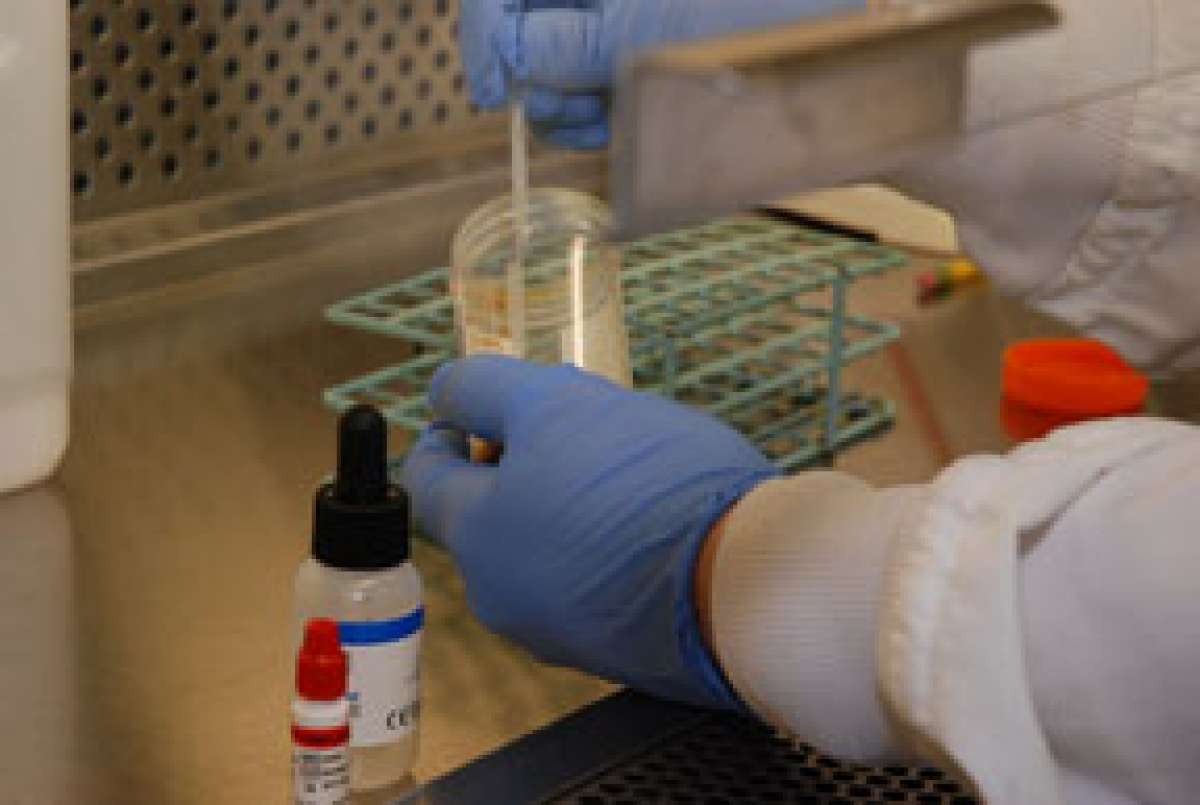 A photo of a lab test being prepared