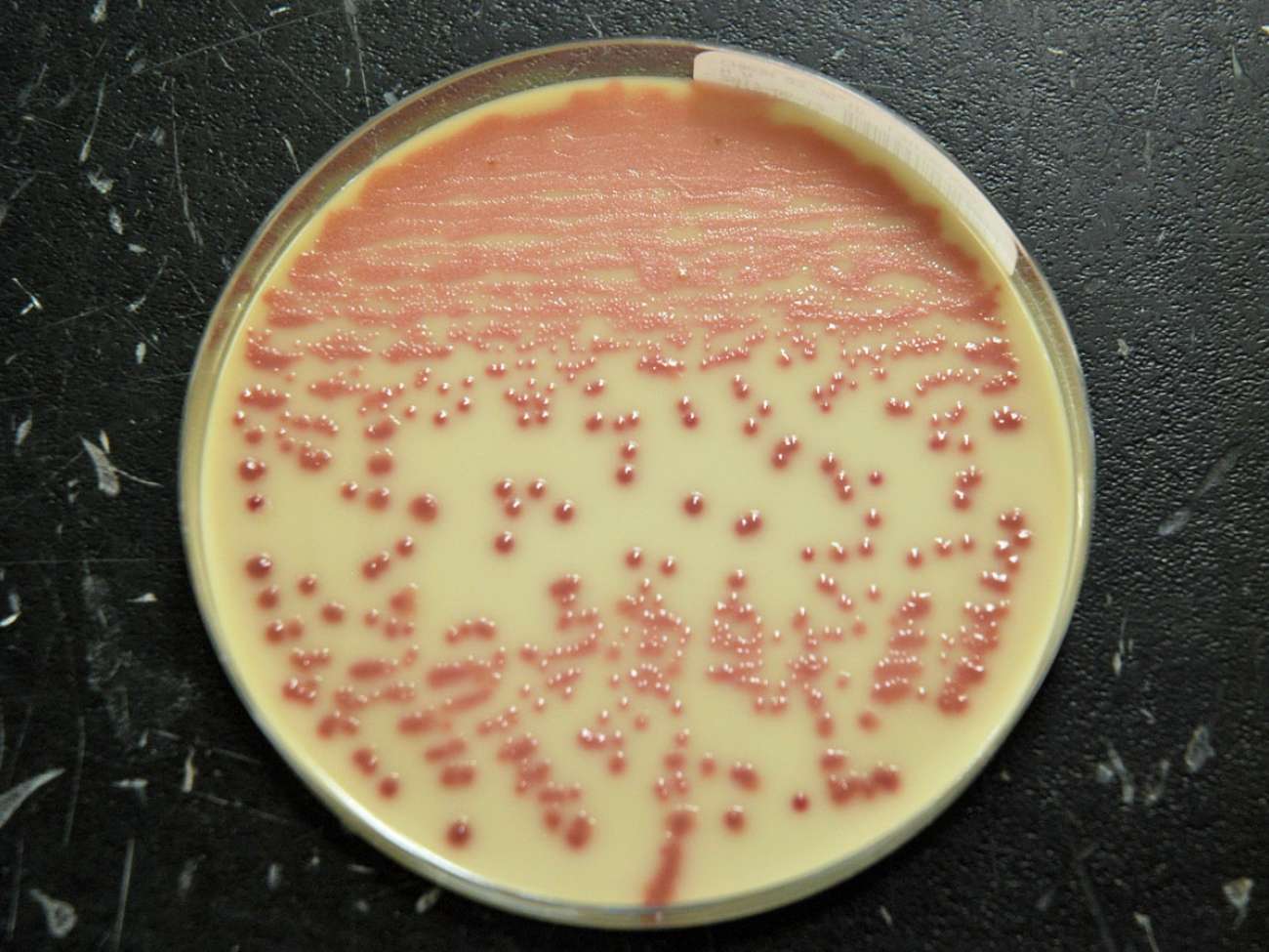 A sample is "streaked" onto a petri dish, and incubated for 24 to 48 hours. Automated streaking can streak more of a petri dish with greater consistency, helping lab staff to grow pathogens more effectively.