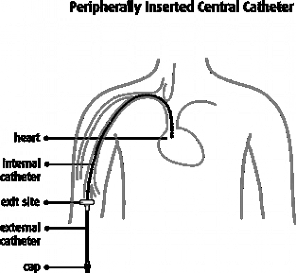 Picc Line