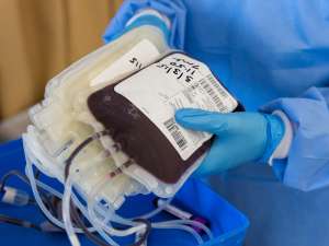 Img 20200702 Research Blood Bag Plasma